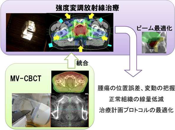 MV-CBCTを用いた画像誘導-強度変調放射線治療
